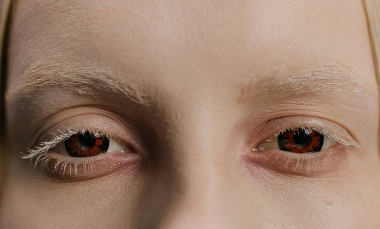 driving bold change forward